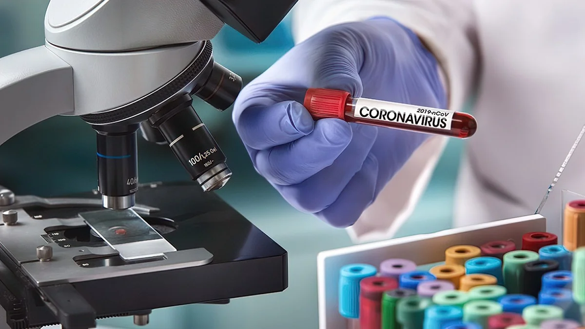 Елімізде соңғы тәулікте 723 адам COVID-19 вирусын жұқтырды
