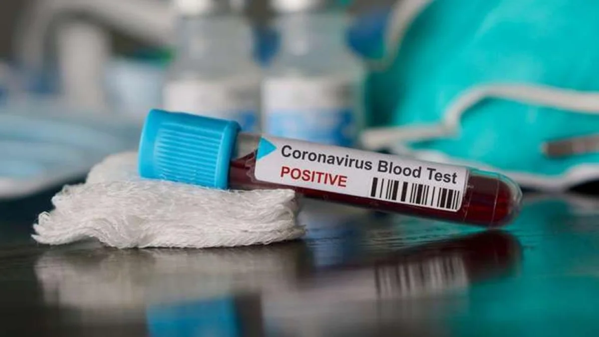 Қазақстанда соңғы тәулікте қанша адамның коронавирус жұқтырғаны белгілі болды