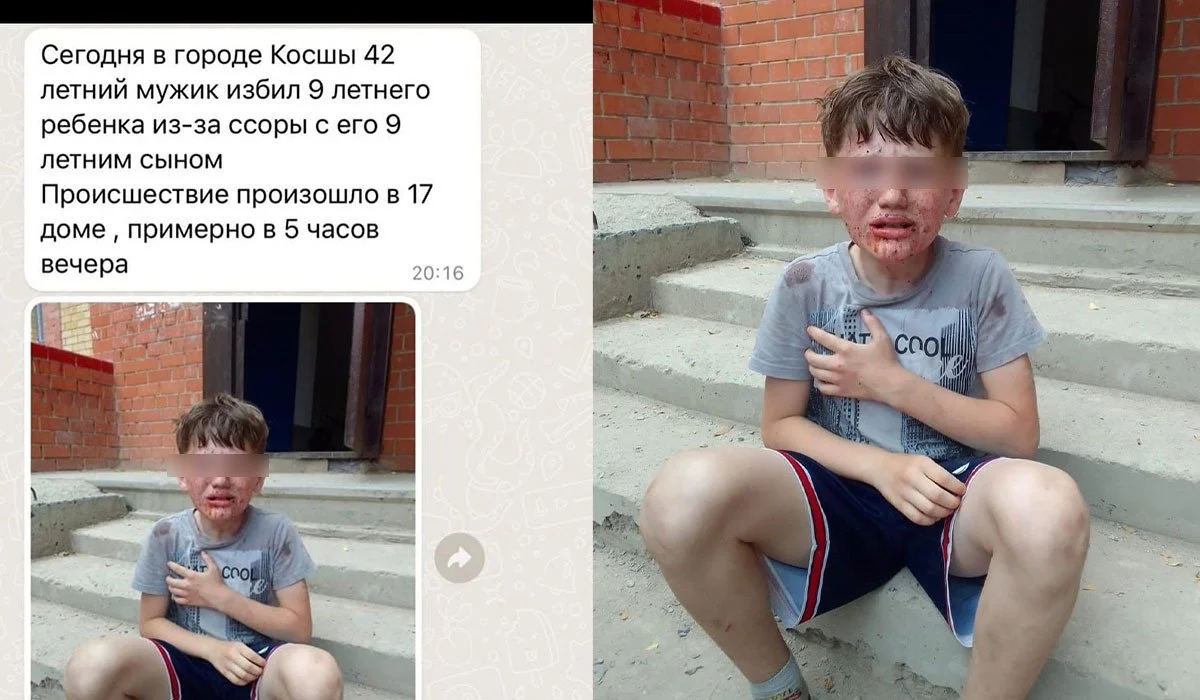 Елорда іргесінде ер адам ұлымен төбелескен баланы қан-жоса етіп соққыға жыққан