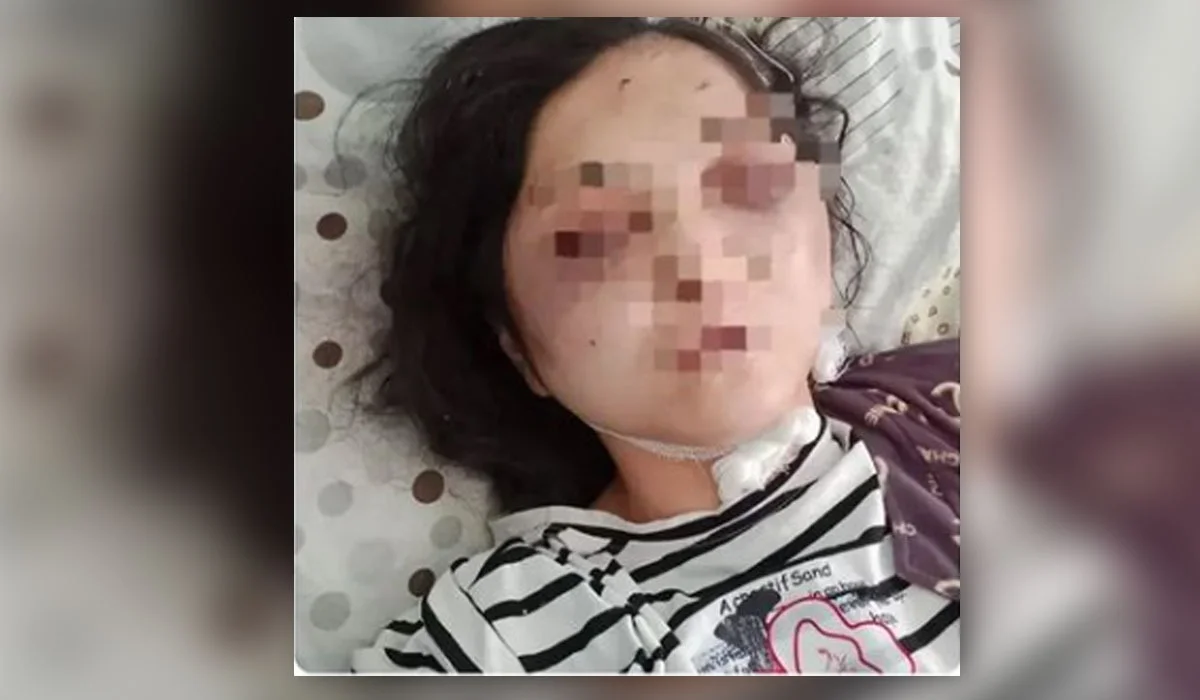 «Көзіме шөп салдың»: Шуда күйеуі әйелін аяусыз соққыға жыққан