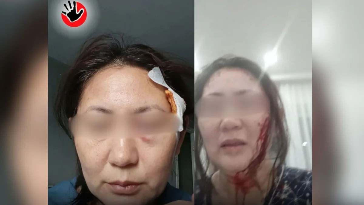 Полиция Ақмола облысында көршісінен оңбай таяқ жеген әйелге қатысты пікір берді