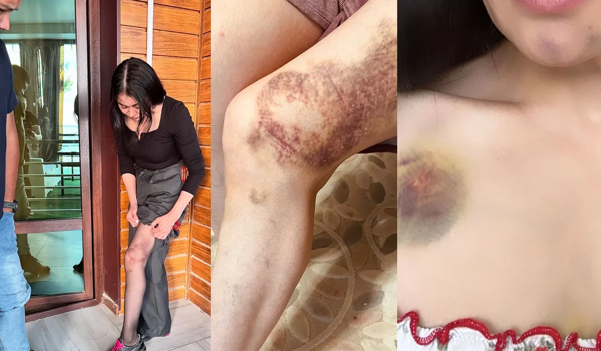 Ақтауда ер адам бұрынғы әйелін өлімші етіп сабап, 17-қабаттан лақтырып жіберетінін айтқан
