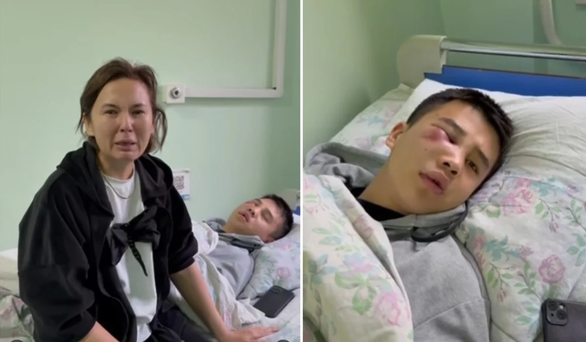 Алматыда ересектер жас жігіттің басын жарып, мұрнын сындырып кеткен (ВИДЕО)