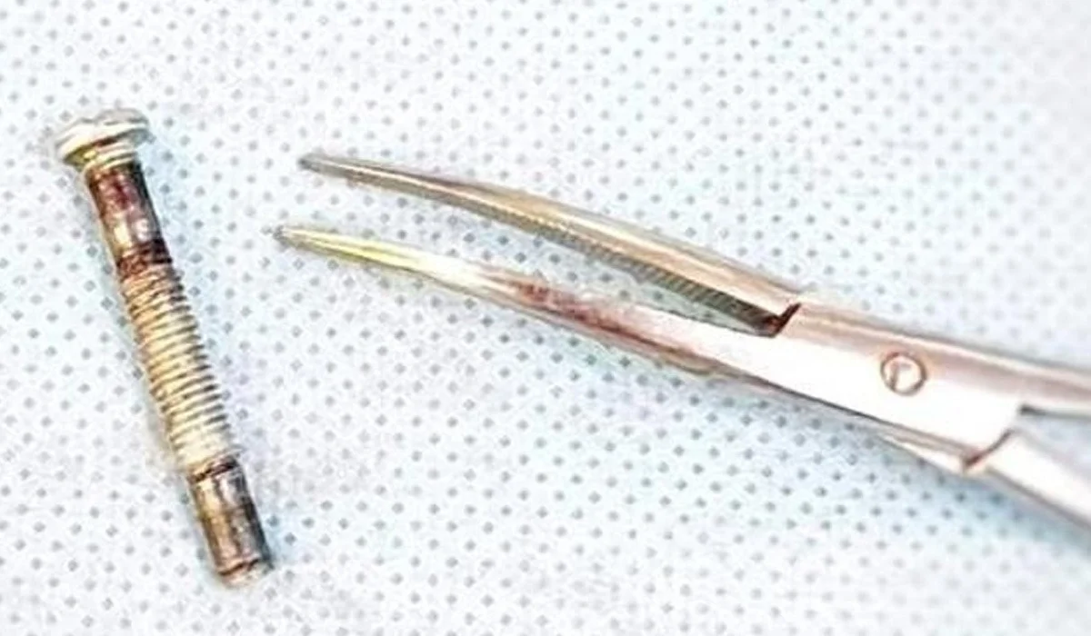 Түркістан облысында бір жасар сәби темір болт жұтып қойған