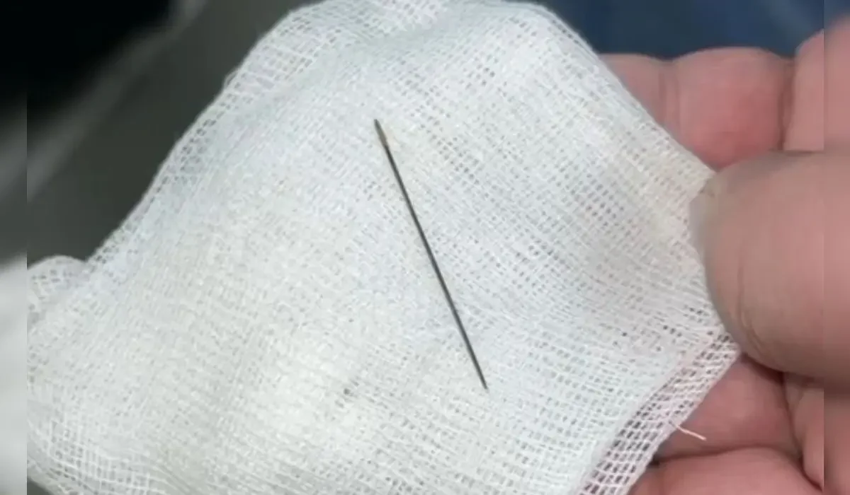 Түркістанда 8 айлық сәбидің ішінен ине шықты