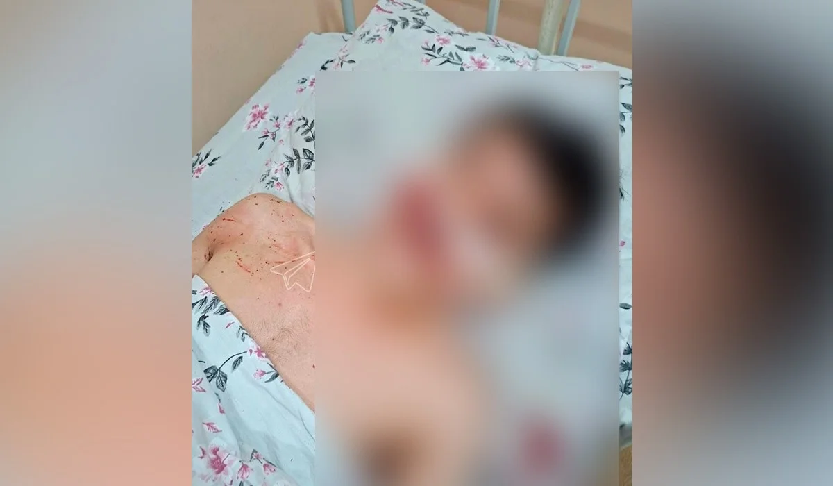 Түркістан облысында көкпардан кейін жас жігітті 25-30 адам өлімші етіп ұрып кеткен