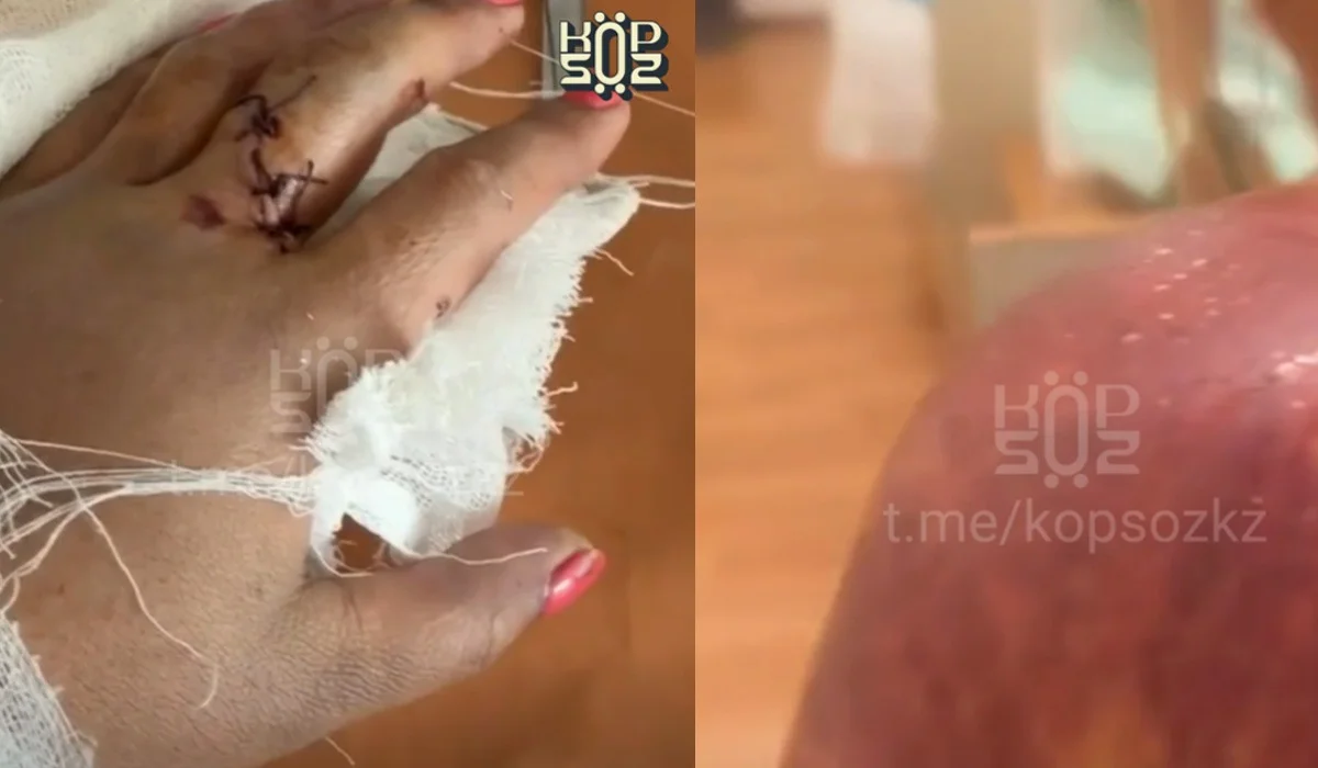 «Сау тамтығы қалмаған»: Жетісу облысында ер адам кішкентай балалалары бар әйелді күрекпен ұрған