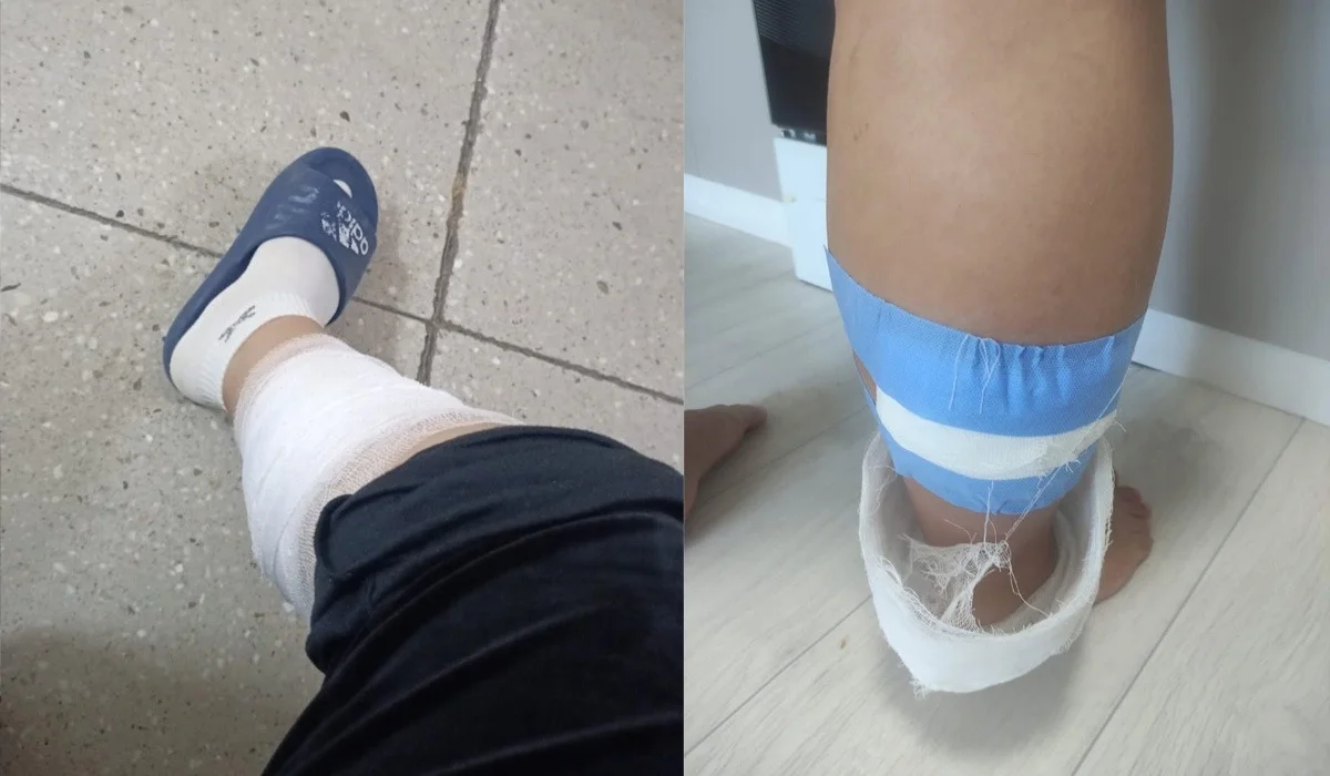 «Енді құтыруға қарсы вакцина алу керек»: Көкшетауда айы-күні жақындаған әйелді бұралқы иттер қауып алған