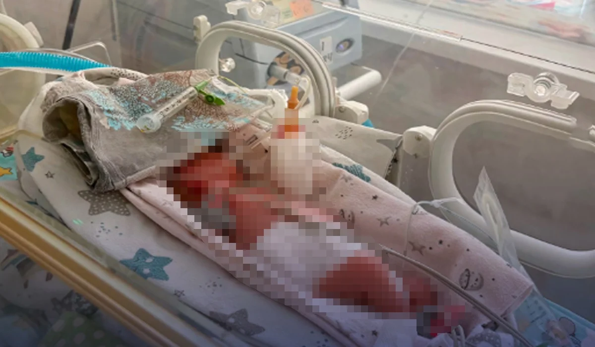 Шымкент дәрігерлері бір сәбидің өмірі үшін 109 күн күрескен