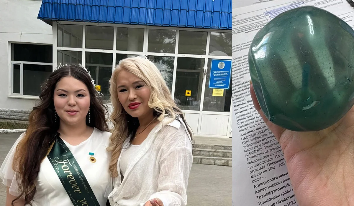 «Бізге 12 миллион теңге ұсынды»: Қостанайда артық салмақ тастау үшін асқазанына баллон орнатқан бойжеткен өліп қала жаздаған