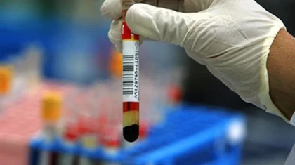 Коронавирусқа шалдықты деген қауіппен ауруханаға жеткізілген студенттің диагнозы белгілі болды