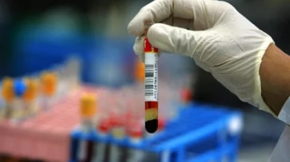 Алматы облысында аяғы ауыр әйелден коронавирус анықталды