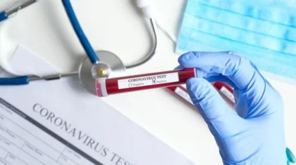 Елордада коронавирус жұқтырған тағы 4 адам тiркелді