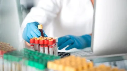 Қазақстанда коронавирус жұқтырғандар саны 927-ге жетті