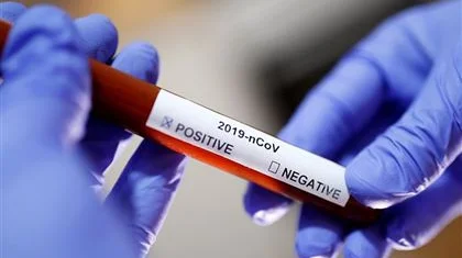 Қазақстанда коронавирус жұқтырғандар саны 2500-ден асты