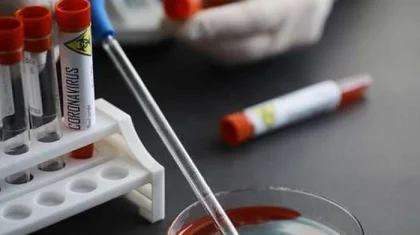 Алматы облысында тіркелген соңғы 6 науқас – Іле ауданының тұрғындары
