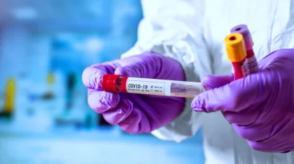Қазақстанда өткен тәулікте COVID-19 вирусын жұқтырған 465 адам тіркелді