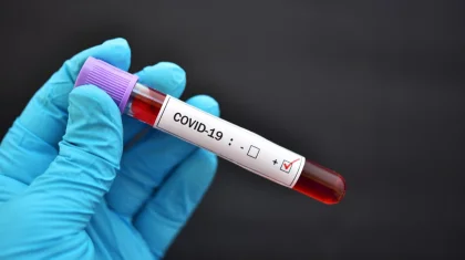 Қазақстанда тағы 492 адамнан COVID-19 вирусы анықталды