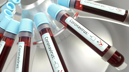 Қазақстанда өткен тәулікте 1501 адамның коронавирус жұқтырғаны белгілі болды