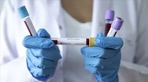 Әлемде коронавирус жұқтырғандар саны 16 миллионнан асты