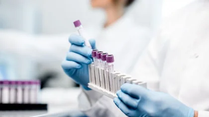 Әлемде коронавирус жұқтырғандар саны 19,2 миллионнан асты
