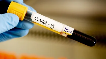 COVID-19: Қазақстанда өткен тәулікте 175 адамнан коронавирус анықталды