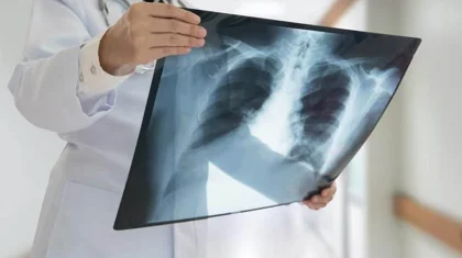 Қазақстанда бір тәулікте 139 адам коронавирустық пневмония жұқтырды