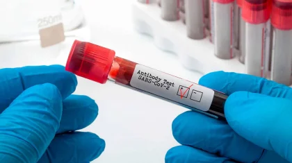 Қазақстанда өткен тәулікте 76 адам коронавирус инфекциясын жұқтырған