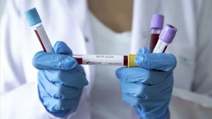 Қазақстанда өткен тәулікте 102 адамнан коронавирус анықталды
