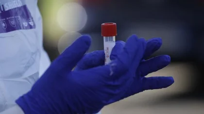 Әлемде коронавирус жұқтырғандар саны 37 миллионнан асты