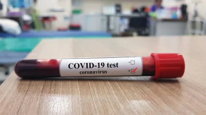 Нұр-Сұлтанға келген әуе жолаушыларының бірінен COVID-19 анықталды