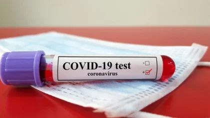 Қазақстанда COVID-19 вирусын жұқтырғандар саны 110 мың адамға жуықтады