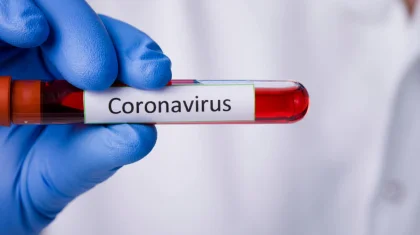 Қазақстанда өткен тәулікте 140 адамнан COVID-19 вирусы анықталды