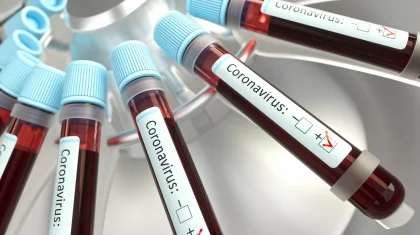 Қазақстанда бір тәулікте 820 адам коронавирус жұқтырған