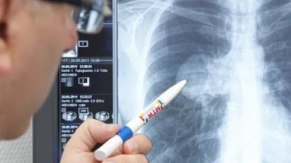 Елімізде бір тәулікте 3 адам пневмониядан көз жұмды