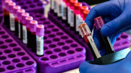 Қазақстанда өткен тәулікте 670 адамнан коронавирус инфекциясы анықталды