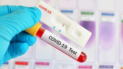 Елімізде өткен тәулікте 733 адамның COVID-19 вирусын жұқтырғаны белгілі болды