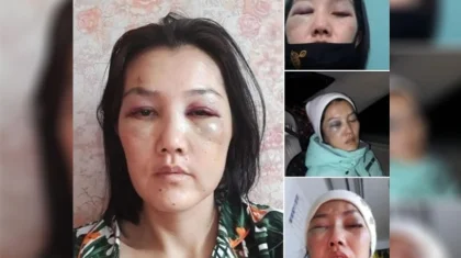 «Өлімші етіп сабады»: экс-күйеуінен қорлық көрген астаналық келіншек көпшіліктен көмек сұрады