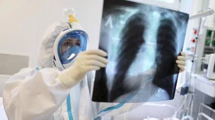 Елімізде өткен тәулікте пневмониядан 3 адам көз жұмды