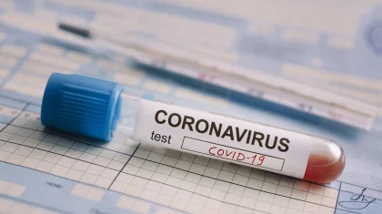 Қазақстанда өткен тәулікте 726 адамнан COVID-19 вирусы анықталды