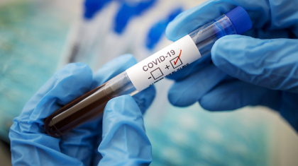 Өткен тәулікте Қазақстанда 835 адамнан COVID-19 вирусы анықталды