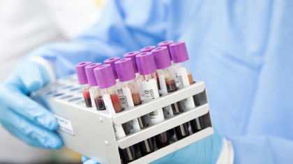 Қазақстанда өткен тәулікте 752 адамнан коронавирус инфекциясы анықталды