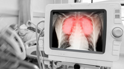 Бір тәулікте коронавирус пен пневмониядан 23 адам көз жұмды
