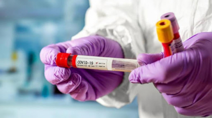 Қазақстанда бір тәулікте 5314 адам коронавирус жұқтырды