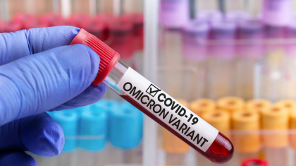 Өткен тәулікте елімізде коронавирус инфекциясын жұқтырған 5 жағдай тіркелді