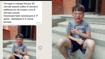 Елорда іргесінде ер адам ұлымен төбелескен баланы қан-жоса етіп соққыға жыққан
