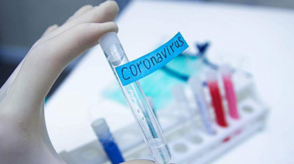 Қазақстанда коронавирус жұқтырғандар саны азайып келеді