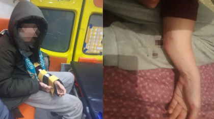 «Дұрыс амандаспағаны үшін қолын сындырды»: Таразда 13 жасар бала құрдасынан таяқ жеді