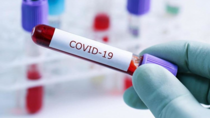 ДДСҰ COVID-19 пандемиясының аяқталғанын жариялады