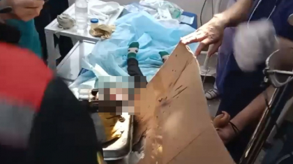 Шымкентте еттартқышқа қолы кептеліп қалған баланың туыстары: Бәрі көзді ашып-жұмғанша болды